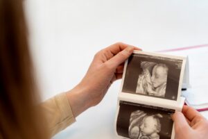 adopción de embriones con donante elegido - ecografía