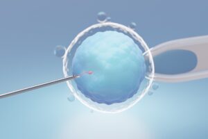 IVF con semen de donante no anónimo -  aguja