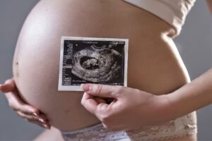 surrogacy in mexico - ultrasound